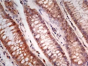 Anti-Caspase 1 antibody [14F468] used in IHC (Paraffin sections) (IHC-P). GTX14367