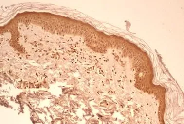 Anti-Caspase 1 antibody [14F468] used in IHC (Paraffin sections) (IHC-P). GTX14367