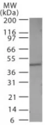 Anti-Caspase 1 antibody used in Western Blot (WB). GTX14368