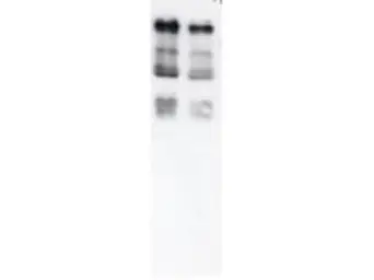 Anti-Ubiquitin antibody used in Western Blot (WB). GTX14372