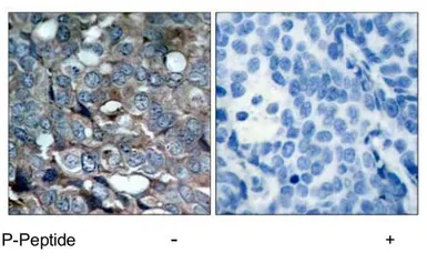 Anti-ASK1 (phospho Ser83) antibody used in IHC (Paraffin sections) (IHC-P). GTX14380