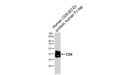 Human CD9 (ECD) protein, human Fc tag. GTX144108-pro