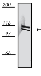 Anti-Dynamin 1 antibody [4E67] used in Western Blot (WB). GTX14448