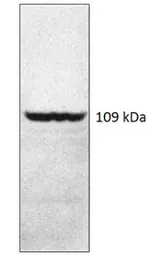 Anti-PDE4A8 antibody used in Western Blot (WB). GTX14606