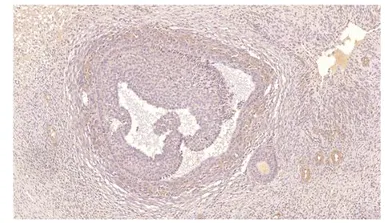 Anti-PDE7A antibody used in Immunohistochemistry (IHC). GTX14616