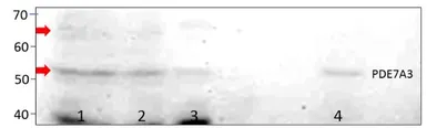 Anti-PDE7A antibody used in Western Blot (WB). GTX14616