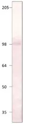Anti-PDE8A antibody used in Western Blot (WB). GTX14618