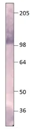 Anti-PDE8A antibody used in Western Blot (WB). GTX14618