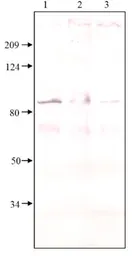 Anti-PDE8A antibody used in Western Blot (WB). GTX14619