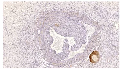 Anti-PDE8B antibody used in Immunohistochemistry (IHC). GTX14621