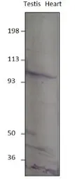Anti-PDE8B antibody used in Western Blot (WB). GTX14621