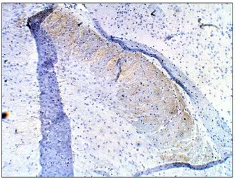 Anti-PDE10A antibody used in IHC (Paraffin sections) (IHC-P). GTX14622