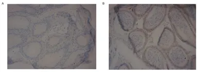 Anti-PDE10A antibody used in Immunohistochemistry (IHC). GTX14622