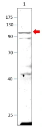 Anti-PDE10A antibody used in Western Blot (WB). GTX14622