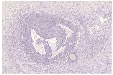 Anti-PDE11A antibody used in Immunohistochemistry (IHC). GTX14623