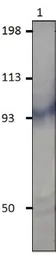 Anti-PDE11A antibody used in Western Blot (WB). GTX14623