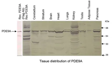 Anti-PDE9A antibody used in Western Blot (WB). GTX14625