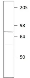 Anti-PDE9A antibody used in Western Blot (WB). GTX14625
