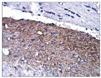 Anti-Calretinin antibody used in IHC (Paraffin sections) (IHC-P). GTX14689
