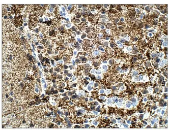 Anti-Calretinin antibody used in IHC (Paraffin sections) (IHC-P). GTX14689