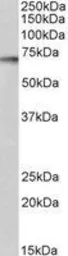 Anti-p70 S6K antibody, C-term used in Western Blot (WB). GTX14708