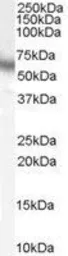 Anti-p70 S6K antibody, C-term used in Western Blot (WB). GTX14708