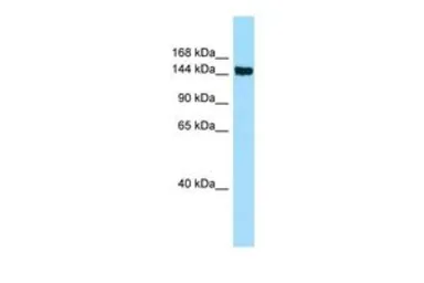 Anti-CD109 antibody, Internal used in Western Blot (WB). GTX14719