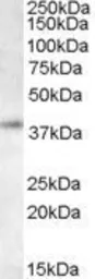 Anti-RNF2 antibody, C-term used in Western Blot (WB). GTX14751