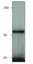 Anti-ACK1 antibody used in Immunoprecipitation (IP). GTX14776