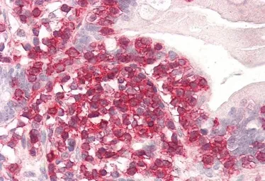 Anti-Coronin 1A antibody used in IHC (Paraffin sections) (IHC-P). GTX14787