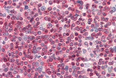 Anti-Coronin 1A antibody used in IHC (Paraffin sections) (IHC-P). GTX14787