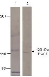 Anti-GUCY2F antibody used in Western Blot (WB). GTX14789