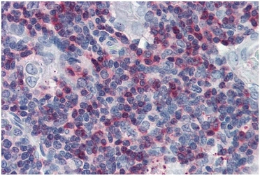 Anti-SLP76 antibody used in IHC (Paraffin sections) (IHC-P). GTX14942