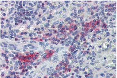 Anti-LIME antibody used in IHC (Paraffin sections) (IHC-P). GTX14945