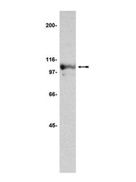 Anti-Nucleolin antibody [4i51] used in Western Blot (WB). GTX14966