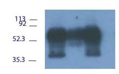 Anti-PAG antibody used in Immunoprecipitation (IP). GTX14989