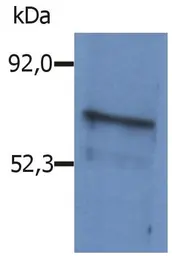 Anti-BLNK antibody used in Western Blot (WB). GTX15008