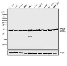 Anti-BCAP31 antibody [CC-4] used in Western Blot (WB). GTX15045