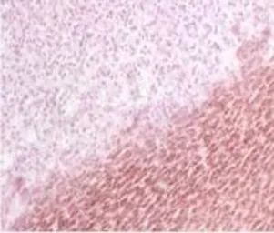Anti-BCAP31 antibody [CC-4] used in IHC (Paraffin sections) (IHC-P). GTX15045