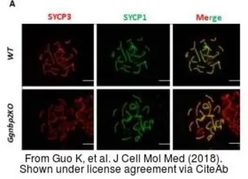 Anti-SCP1 antibody used in Immunocytochemistry/ Immunofluorescence (ICC/IF). GTX15087