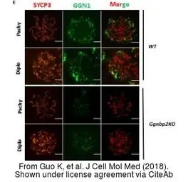 Anti-SCP3 antibody used in Immunocytochemistry/ Immunofluorescence (ICC/IF). GTX15092