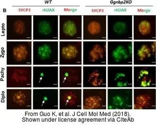 Anti-SCP3 antibody used in Immunocytochemistry/ Immunofluorescence (ICC/IF). GTX15092