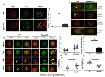 Anti-SCP3 antibody used in Immunocytochemistry/ Immunofluorescence (ICC/IF). GTX15092