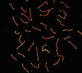 Anti-SCP3 antibody used in Immunocytochemistry/ Immunofluorescence (ICC/IF). GTX15093