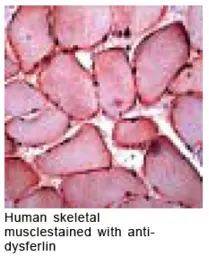 Anti-Dysferlin antibody (Ready-to-use) used in Immunohistochemistry (IHC). GTX15109