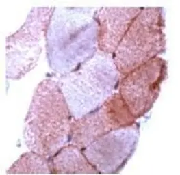 Anti-Dysferlin antibody (Ready-to-use) used in IHC (Paraffin sections) (IHC-P). GTX15109
