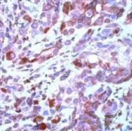 Anti-Tyrosinase antibody used in Immunohistochemistry (IHC). GTX15175