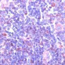 Anti-Syk antibody [SPM147] used in Immunohistochemistry (IHC). GTX15238