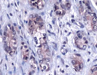 Anti-FRA2 antibody used in IHC (Paraffin sections) (IHC-P). GTX15296