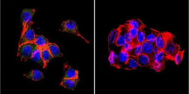 Anti-OATP2 + OATP8 antibody [MDQ] used in Immunocytochemistry/ Immunofluorescence (ICC/IF). GTX15442